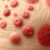 Objawy i leczenie przewlekłych dermatoz: Skórne zmiany i terapia